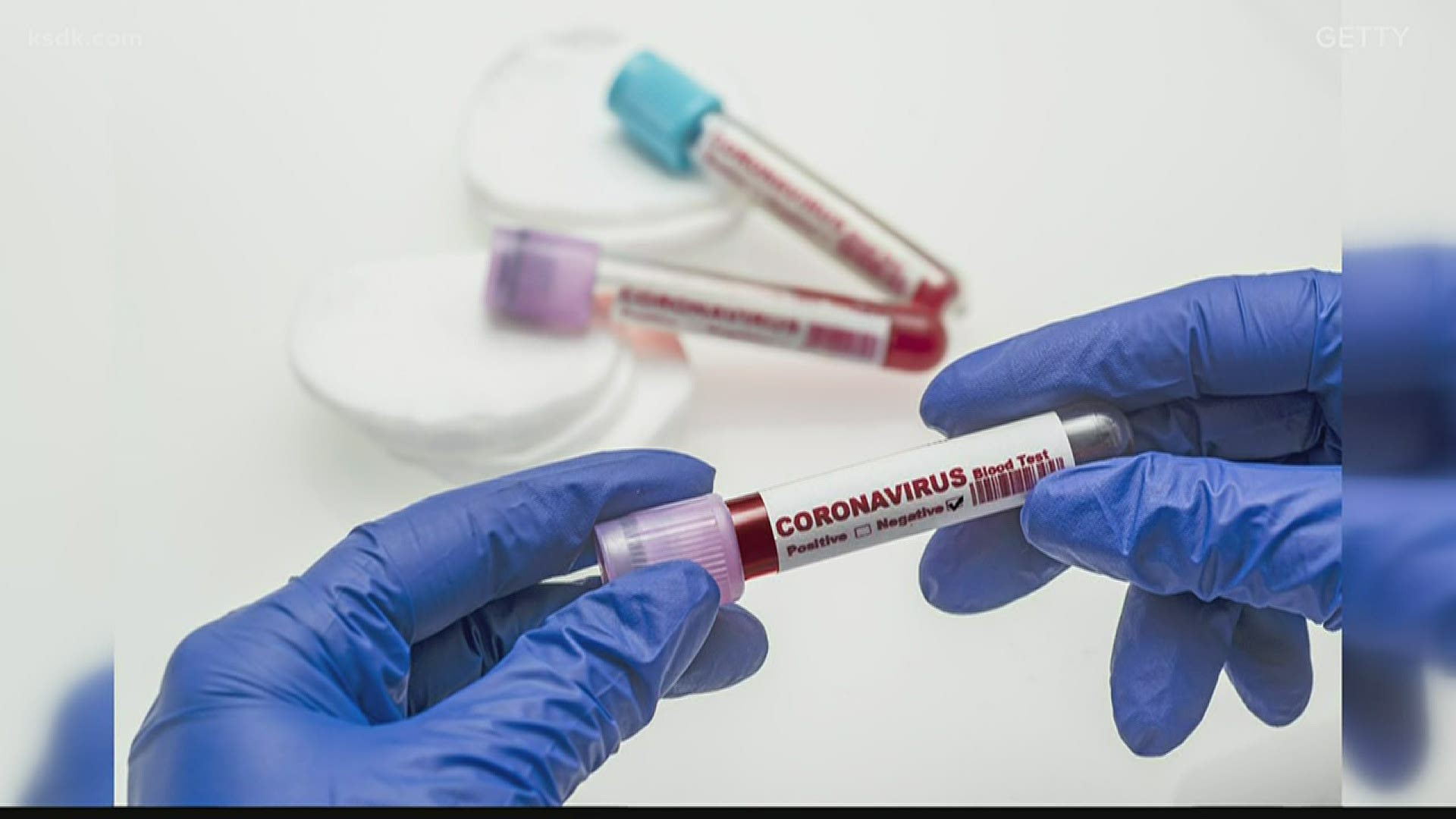 Желающие ревакцинироваться должны сдать тест на антитела