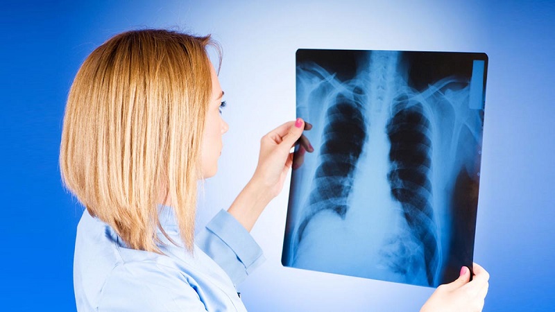 Заболеваемость туберкулезом в РК в январе – ноябре 2019 года снизилась на 2,1%  
