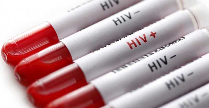 В Казахстане удается сдерживать эпидемию ВИЧ/СПИД   